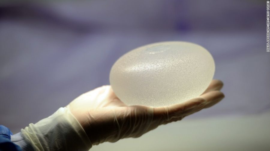La FDA reporta 9 muertes por un extraño cáncer asociado con implantes mamarios