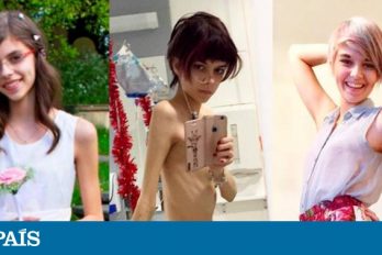 De la anorexia a un cuerpo sano en diez años