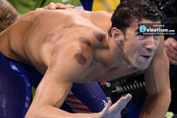 Conoce la razón de los moretones circulares en los cuerpos de algunos deportistas olímpicos