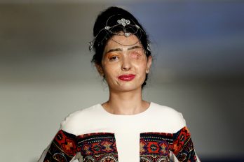 Una modelo atacada con ácido abrió la semana de la moda en Nueva York