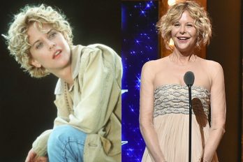 ¿Qué les pasó? 15 celebridades que lucen irreconocibles por culpa de la cirugía plástica
