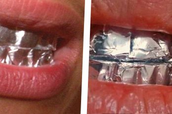 Esto es lo que pasa cuando envuelves tus dientes en papel aluminio. ¡Es instantáneo!