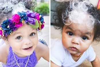 ¿Por qué esta niña tiene un mechón de pelo blanco?