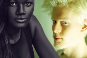 Belleza en blanco y negro: modelos que convirtieron el inusual color de su piel en tendencia. ¡Bienvenida la diversidad!