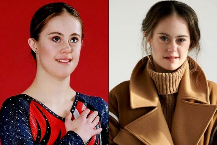 La historia de la campeona de gimnasia y modelo con síndrome de down