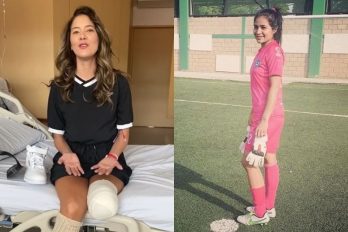 Voz de apoyo de Daniella Álvarez a la arquera que perdió su pierna: “aférrate a la vida”