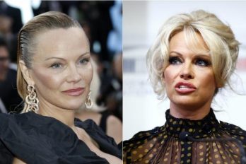 ¿Qué le pasó al rostro de Pamela Anderson?